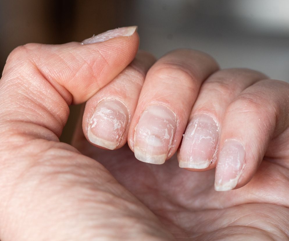 Manicure żelowy może mieć groźne konsekwencje. Naukowcy ostrzegają przed lampami UV