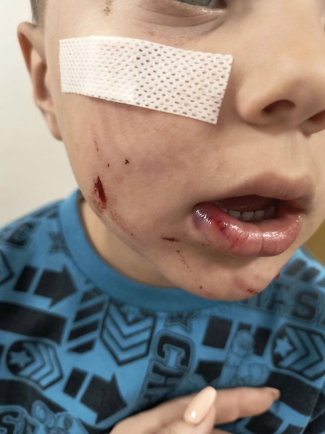 Pogryziony Franek potrzebuje pomocy. Policja szuka właściciela psa. Do szpitala dotarła anonimowa wiadomość