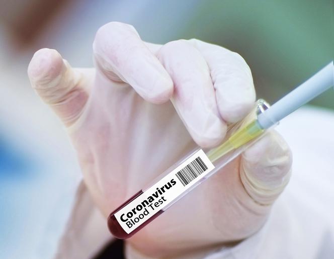 Covid nie odpuszcza. Nie będzie odmrożeń