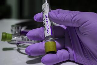 Epidemia koronawirusa: Prawie 2500 zakażeń na Dolnym Śląsku! [RAPORT 27.06.2020]