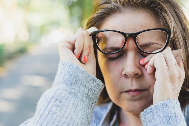 Masz alergię i swędzą cie oczy? Unikaj ich dotykania w czasie pandemii!
