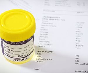 Ureaplasma urealyticum – przyczyna zakażenia układu MOCZOWO-PŁCIOWEGO