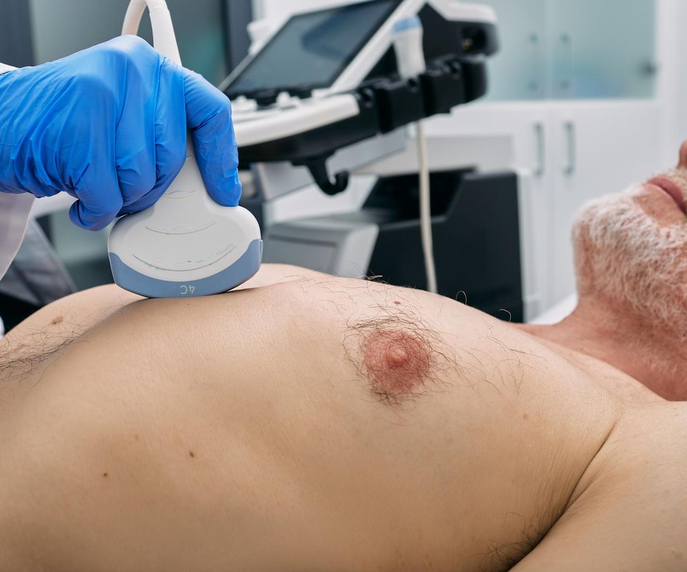 To już niemal epidemia. Te choroby najczęściej zabijają Polaków