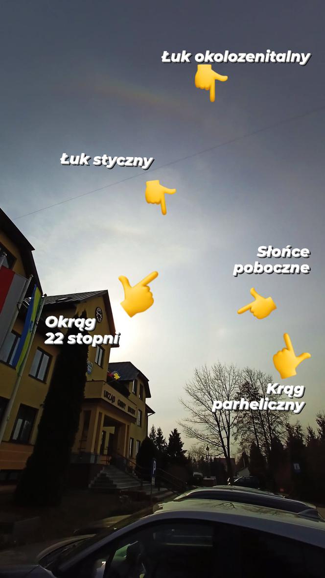 Łuk okołozenitalny