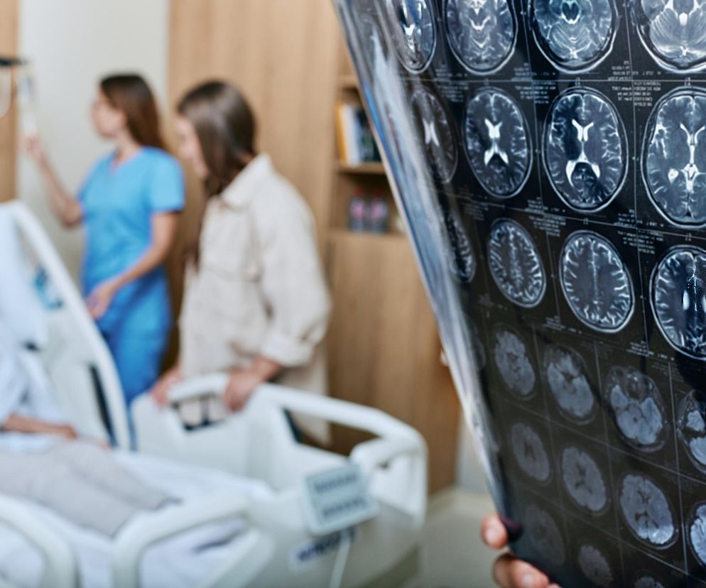 Niezwykłe odkrycie dotyczące demencji. Choroba nie zawsze dawała o sobie znać