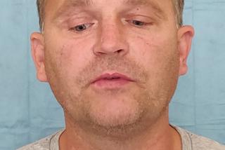 Wydrukowali mu nowe kości twarzy