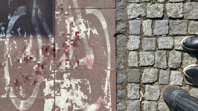 Atak nożownika pod kebabem w Warszawie