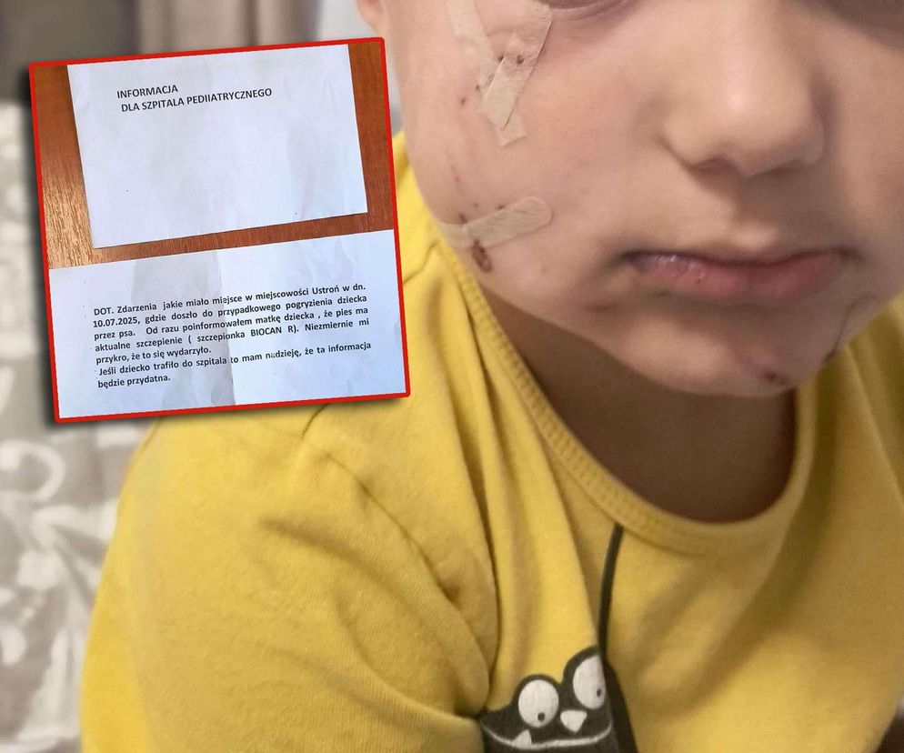 Pogryziony Franek potrzebuje pomocy. Policja szuka właściciela psa. Do szpitala dotarła anonimowa wiadomość