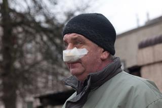 Zrobimy panu Irkowi nowy nos