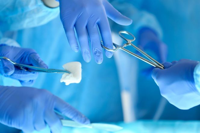 Laparoskopia diagnostyczna
