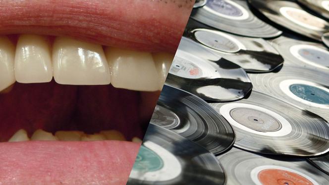 Słuchaj muzyki zębami - jak zamienić własną szczękę w gramofon?