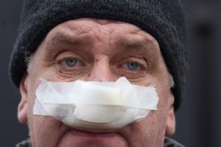 Zrobimy panu Irkowi nowy nos