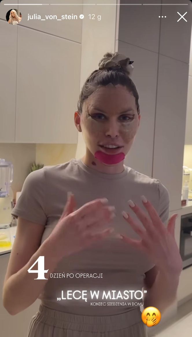 Julia von Stein po operacji