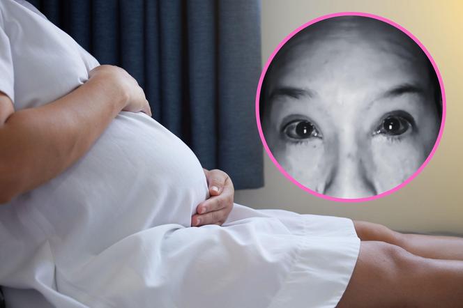Urodziła 4,5 kg synka siłami natury. Tak wyglądały jej oczy po porodzie. 