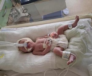 Dzień Wcześniaka w Szpitalu św. Zofii w Warszawie