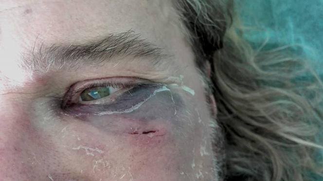 Miał wystąpić na Woodstocku. Został brutalnie pobity