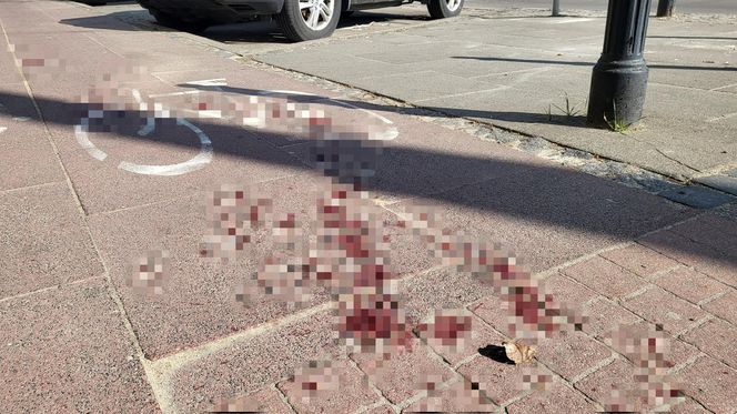 Atak nożownika pod kebabem w Warszawie