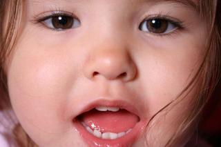Probiotyki dla niemowlaka - jeśli chcesz uniknąć w przyszłości problemów z zębami u dziecka