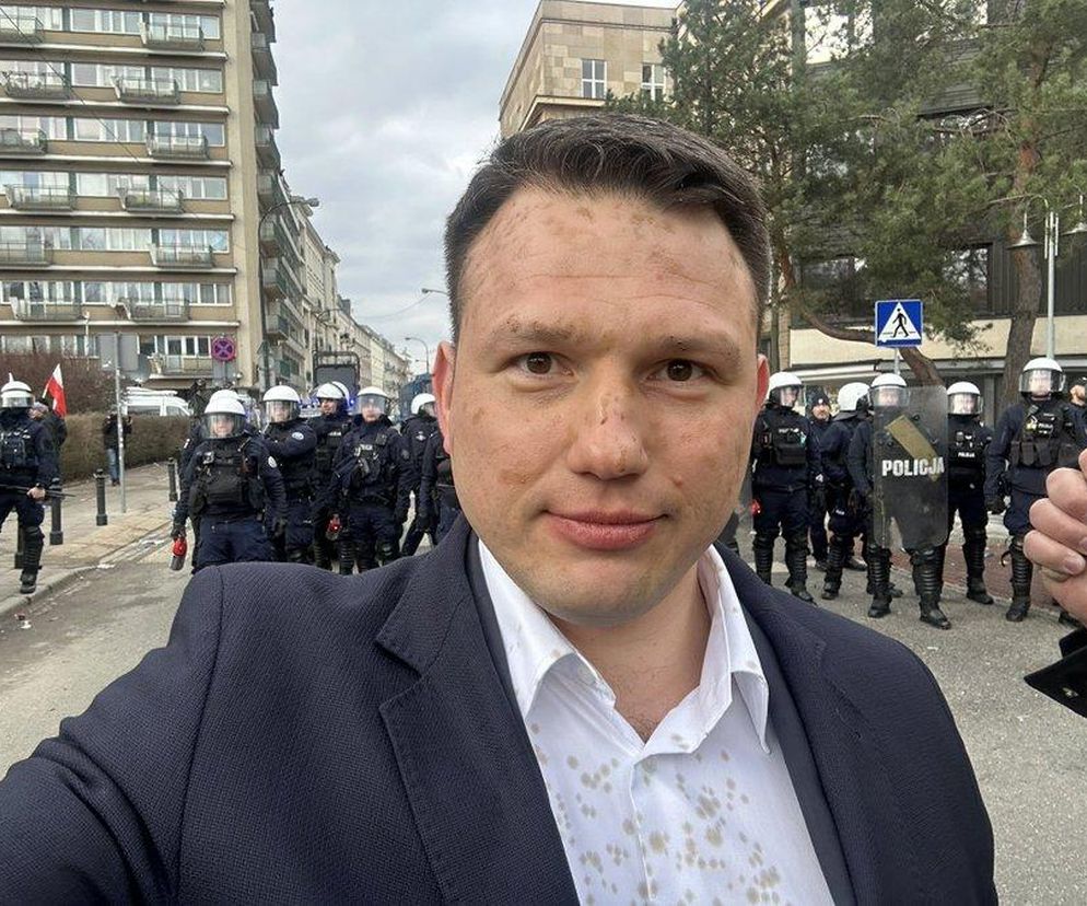 Mentzne pokazał twarz, po tym, jak miał zostać spryskany gazem! Musieli pomóc medycy