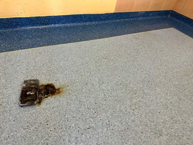 Nie było „dymka”, więc cisnął telefonem! Alarm w szpitalu, strażacy w akcji