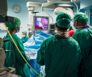 Rękawowa (mankietowa) resekcja żołądka: wady i zalety [film z operacji]