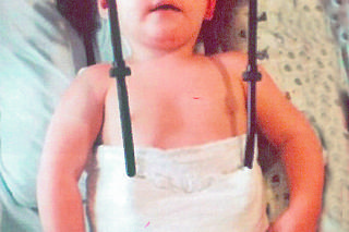 Urwało mu główkę i przeżył