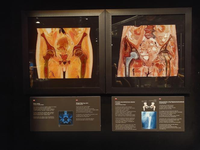 Wystawa Body Worlds w Szybie Wilson w Katowicach