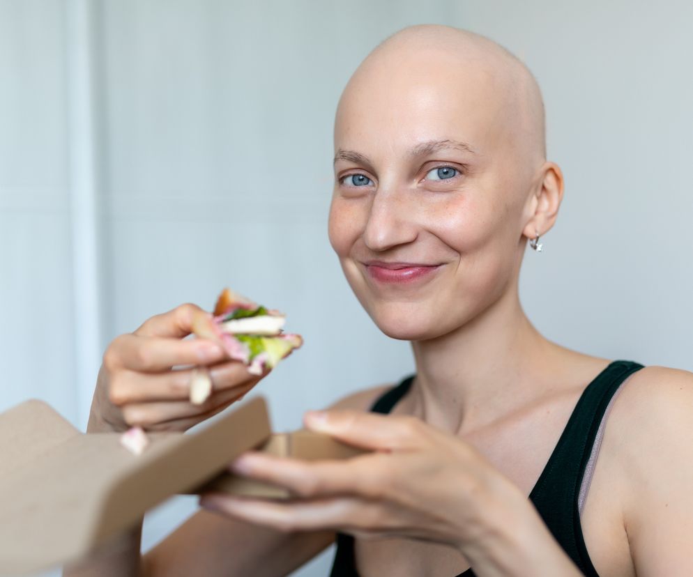 Łysienie plackowate to choroba autoimmunologiczna