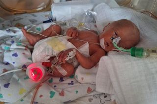 Dzień Wcześniaka w Szpitalu św. Zofii w Warszawie