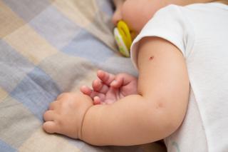 Szczepienie na gruźlicę - czy nadal jest konieczne i czy jest bezpieczne dla noworodka?