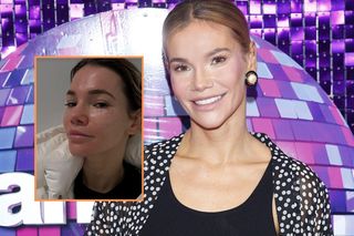 Maja Bohosiewicz w fatalnym stanie! Kontuzja żeber to dopiero początek kłopotów