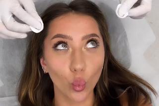 Top Model Klaudia Nieścior robi botoks