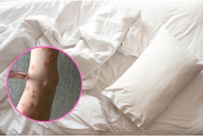 Wakacje zmieniły się w koszmar. W hotelowym pokoju były ich tysiące