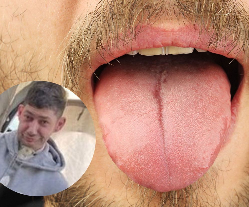 Przez raka stracił język. Ma nieuleczalny nowotwór i nie może pożegnać się z rodziną