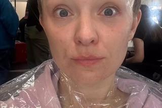 Basia Kurdej-Szatan oszpecona