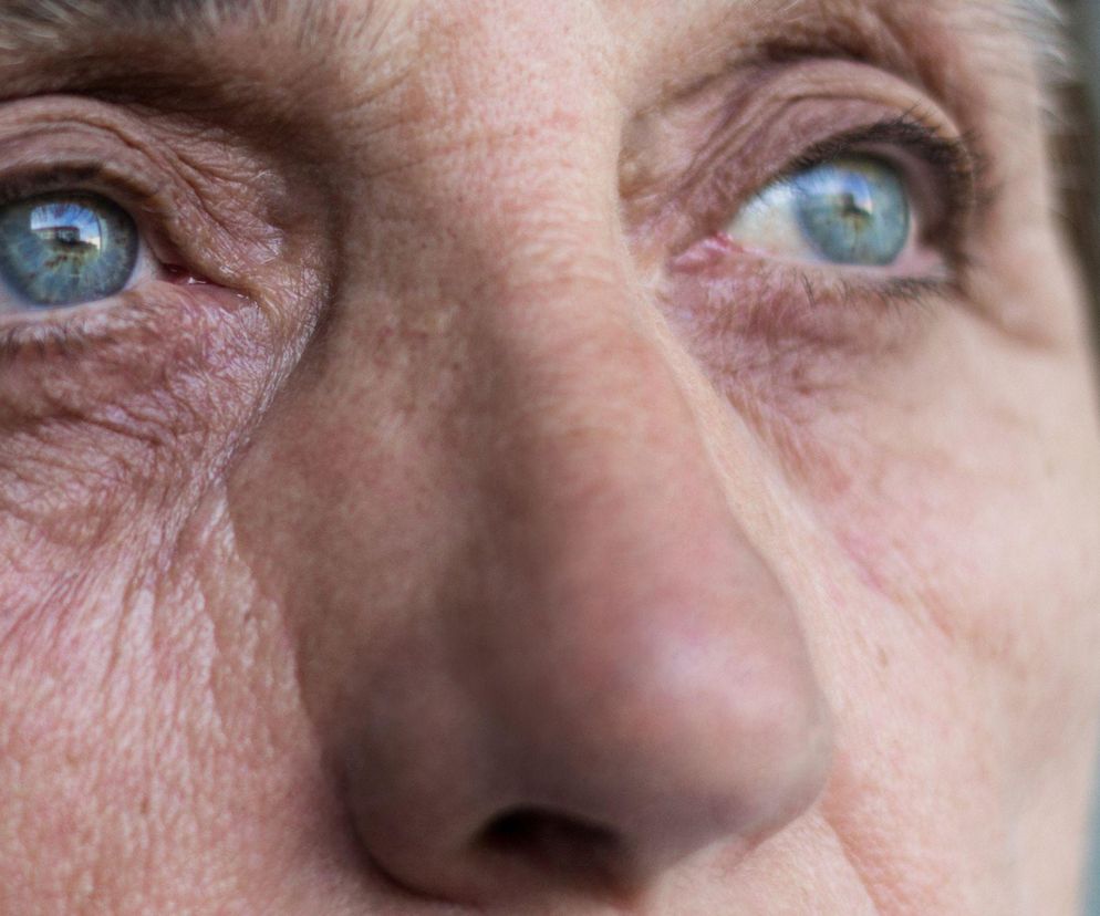 Eksperci: choroba siatkówki może uszkodzić wzrok w 2-3 miesiące