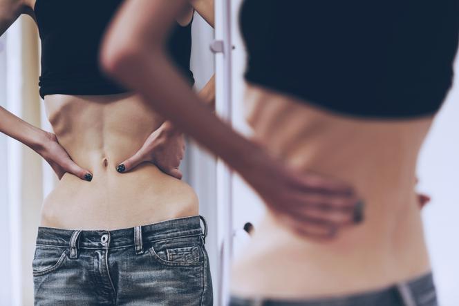 Anoreksja (jadłowstręt psychiczny) - objawy i leczenie
