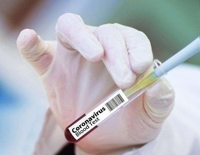 Masz TĘ grupę krwi? Możesz być bardziej odporny na zakażenie koronawirusem!