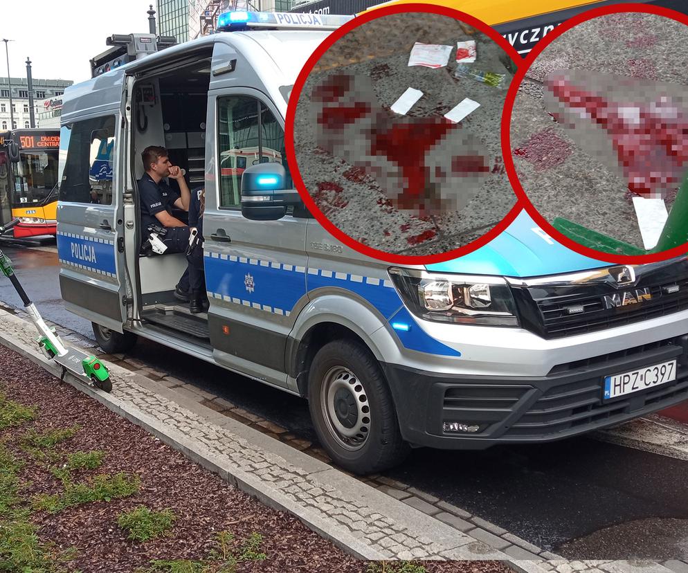 Potrącenie mężczyzny przez hulajnogę w centrum Warszawy. Cały chodnik był we krwi!