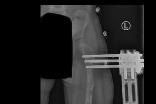 Córeczka policjantów cierpi każdego dnia. Potrzebna kosztowna operacja [ZDJĘCIA]