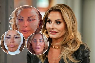 Kaźmierska naciągnięta do granic możliwości! Ma 50 lat i zero zmarszczek. Tak wygląda 2 tygodnie po liftingu