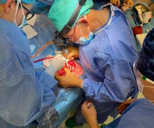Operacja pacjentki z nowotworem oczodołu