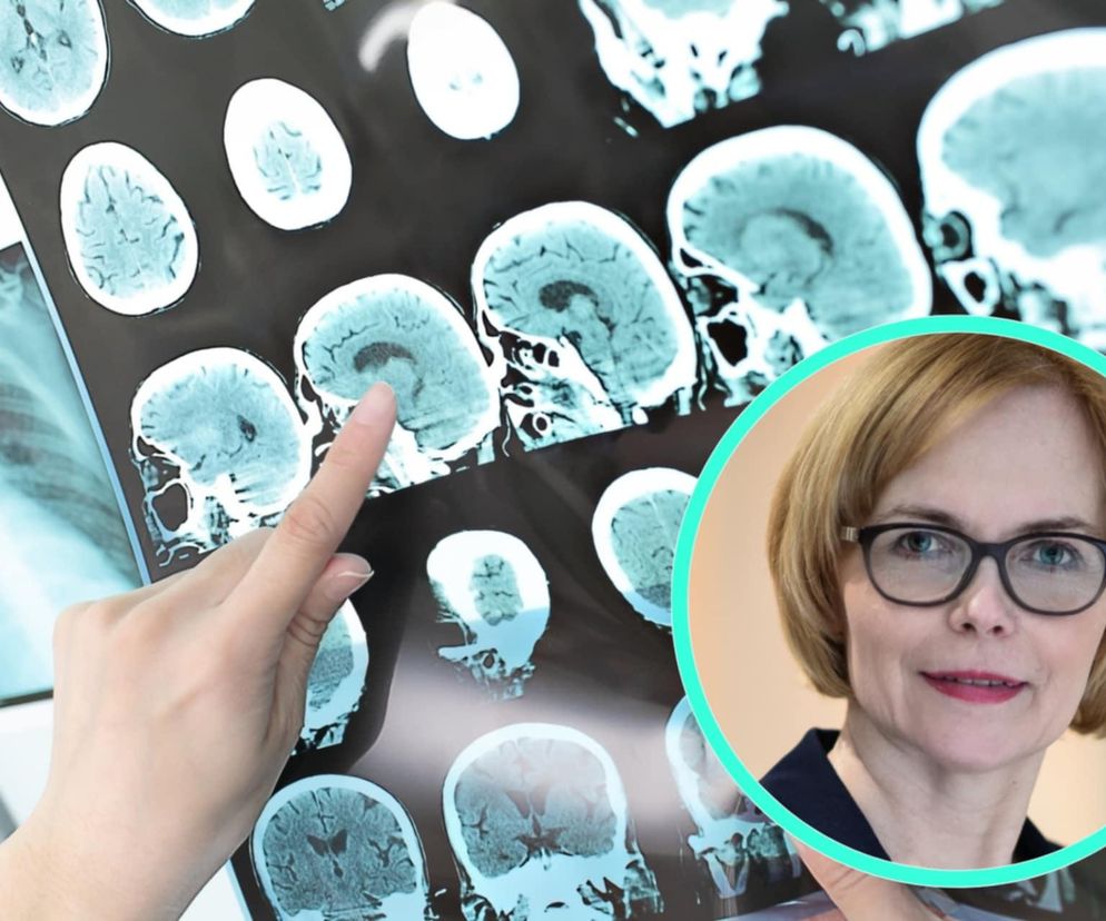 SM - nieleczona choroba odbierała przyszłość. Zagrożeniem niedoszacowane kontrakty