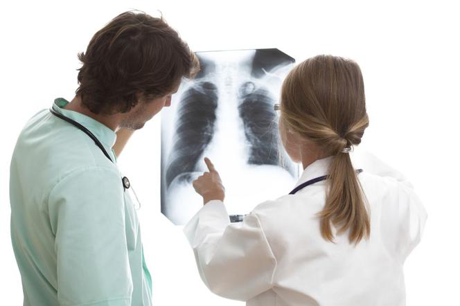 Rak płuca: rozpoznanie. Badanie patomorfologiczne umożliwia dokładne rozpoznanie raka płuca