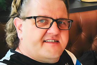 Pracownik UKW w Bydgoszczy potrzebuje pomocy.  Obcięto mi najpierw trochę palca. Po próbie ratowania, nastąpiła  amputacja połowy stopy
