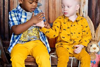 Urodziłam czarno-białe bliźniaki! Niezwykłe rodzeństwo 