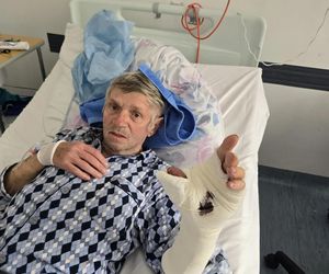 Palec czy papierosy? Emeryt podjął dramatyczną decyzję. Dziś ma i kciuka i nowe życie