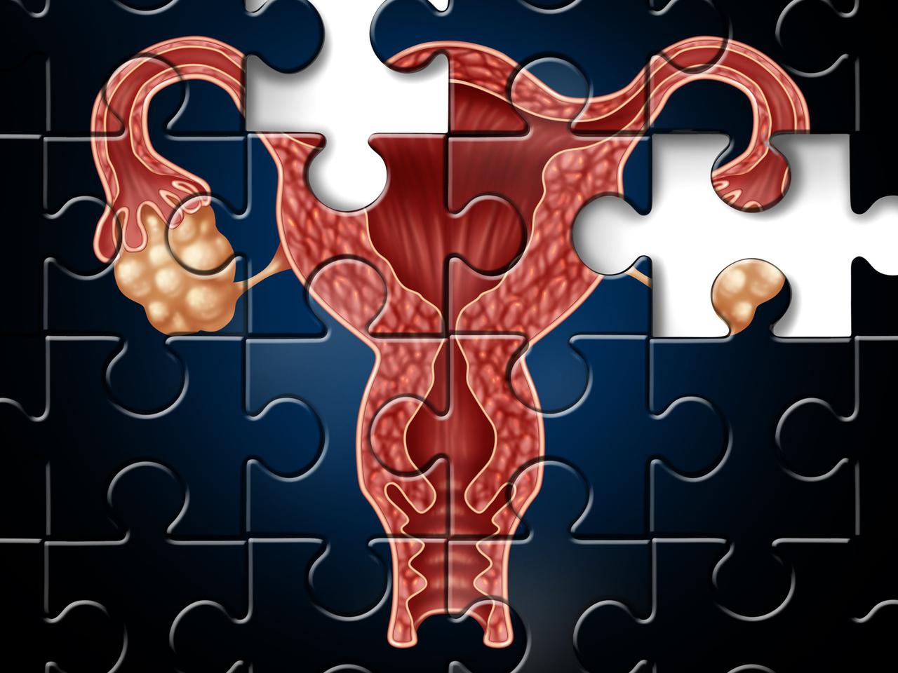 Menopauza - w jakim wieku występuje? Objawy przekwitania