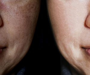 Domowa mikrodermabrazja. Kosztuje 2zł, a efekt jak z profesjonalnego salonu