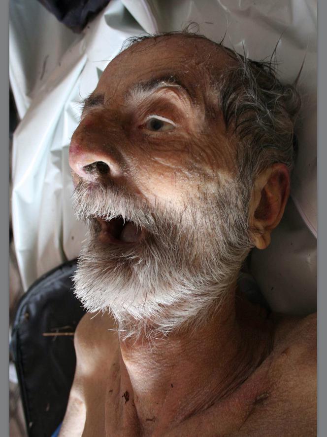 Tajemnicze zwłoki w walizce